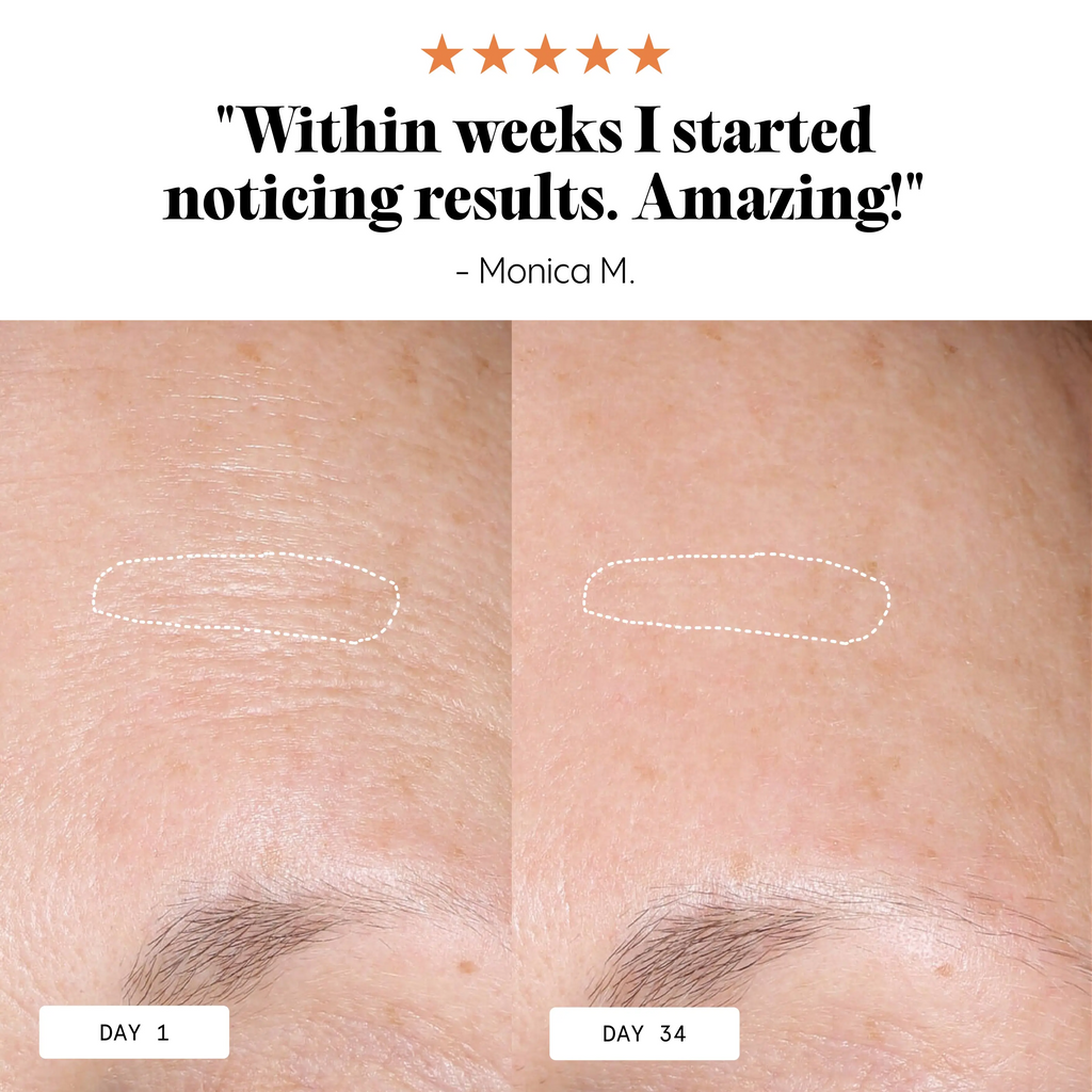 Sea Buckthorn and Pomegranate Anti-Aging Day Balm | 22% Younger Skin in 7 Days | 30g