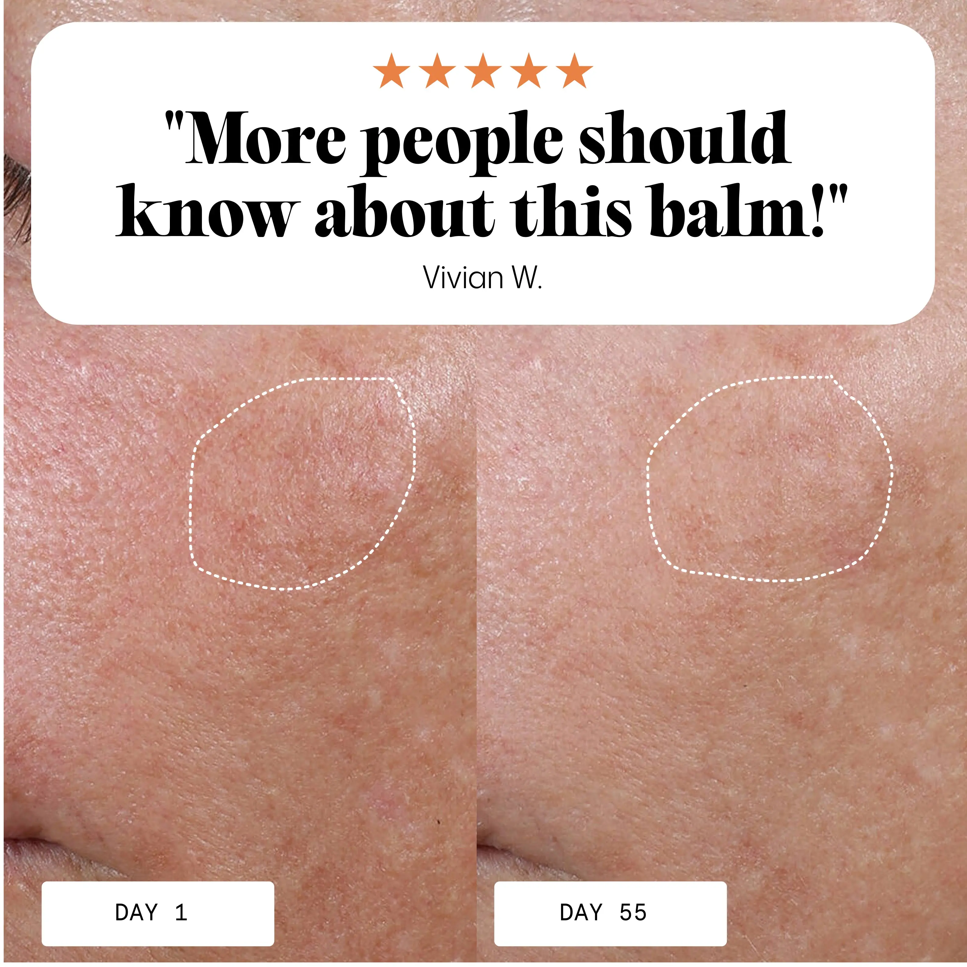 Sea Buckthorn and Pomegranate Anti-Aging Day Balm | 22% Younger Skin in 7 Days | 30g