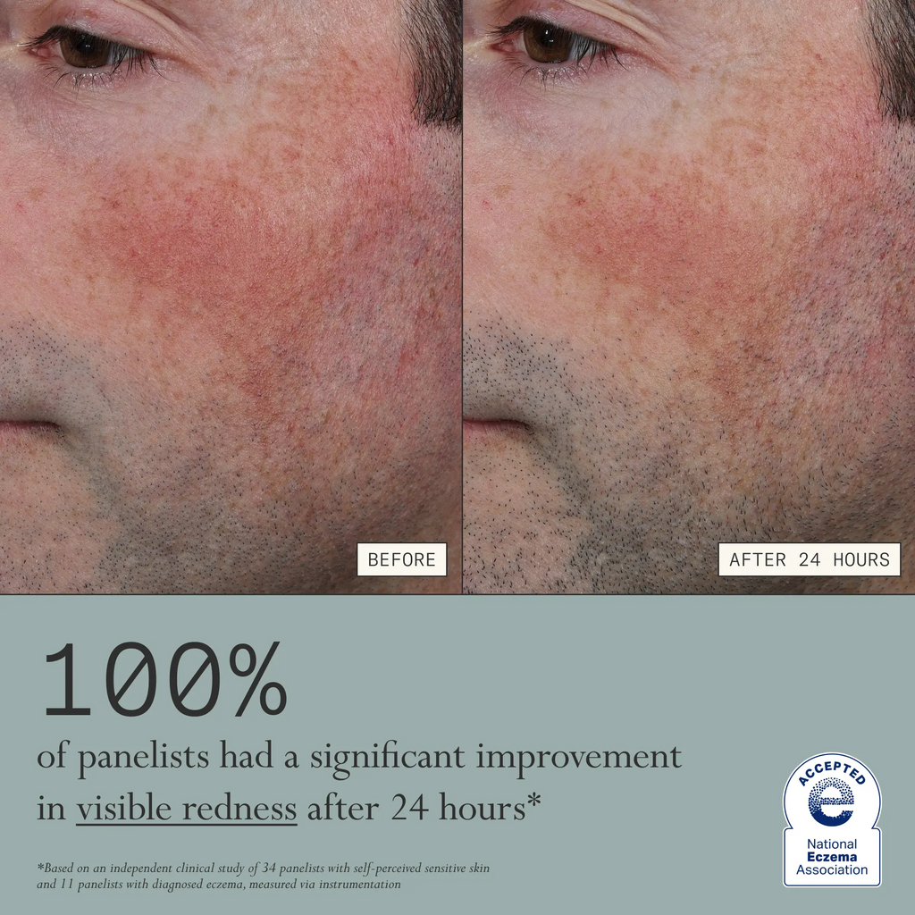 Skin Mercy Recovery Cream – 1% Colloidal Oatmeal Moisturizer for Sensitive, Dry & Irritated Skin | Clinically Proven